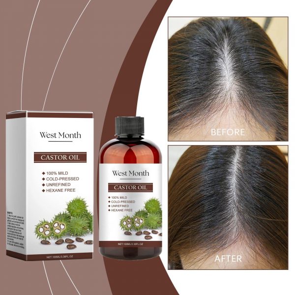 Xiyue All-in-one Castor Oil Is An Essential Oil For Multi-effect Care, Moisturizing Skin, Eyelashes And Eyebrows