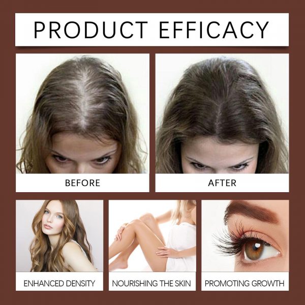 Xiyue All-in-one Castor Oil Is An Essential Oil For Multi-effect Care, Moisturizing Skin, Eyelashes And Eyebrows