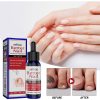 EELHOE Nail Repair Solution, Hands And Feet Nail Repair Moisturizing Clean And Remove Gray Nail Repair Solution