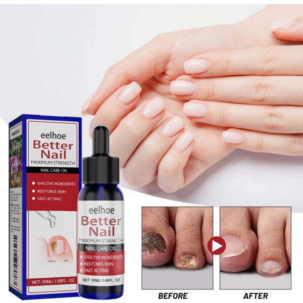 EELHOE Nail Repair Solution, Hands And Feet Nail Repair Moisturizing Clean And Remove Gray Nail Repair Solution