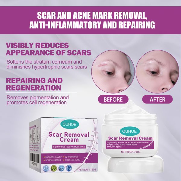 OUHOE Skin Care Cream Gently Nourishes And Lubricates Improving Skin Daily Care Facial Body Care Cream