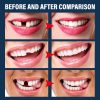 EELHOE Denture Decorative Teether Set, Halloween Vampire Makeup Dress Up Fake Tooth Glue Teeth Props
