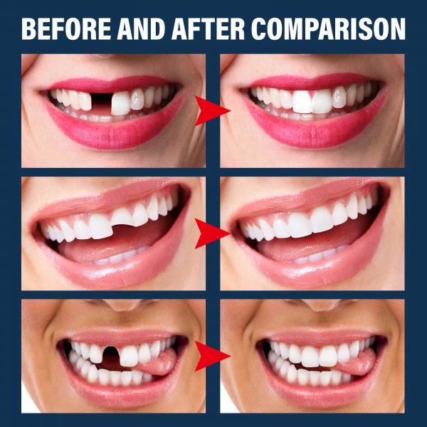 EELHOE Denture Decorative Teether Set, Halloween Vampire Makeup Dress Up Fake Tooth Glue Teeth Props