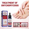 EELHOE Nail Repair Solution, Hands And Feet Nail Repair Moisturizing Clean And Remove Gray Nail Repair Solution