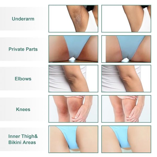 Crema blanqueadora de piel para aclarar la piel para áreas íntimas del cuerpo, partes privadas, axilas, rodillas, codos, muslo interior, área del bikini, crema blanqueadora removedor de